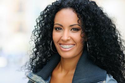 north york woman with braces smiling