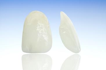 dental veneers in north york