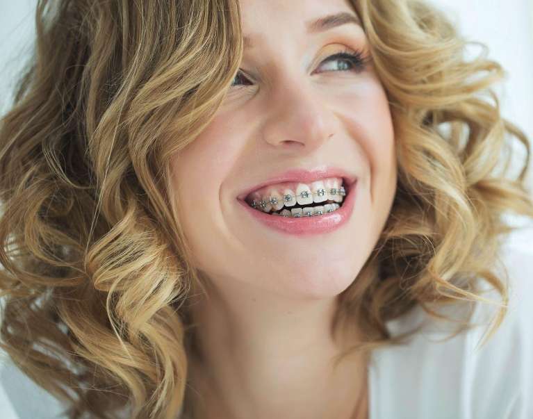 north york woman with braces 