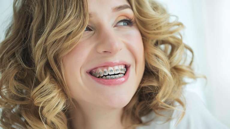 woman with metal braces in north york