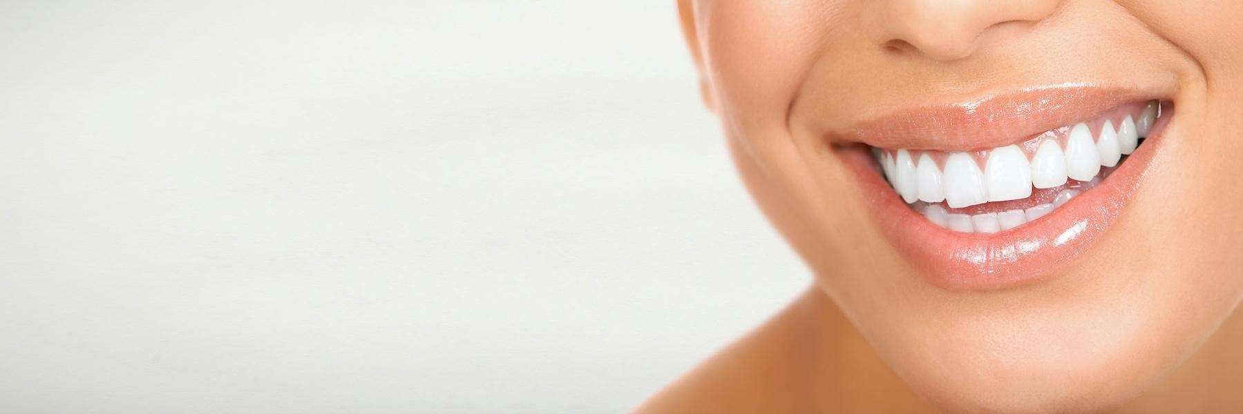 close up of a smile after a dental checkup in north york